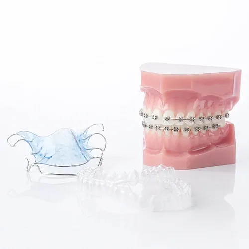 Vergleich verschiedener kieferorthopädischer Behandlungsmethoden mit Metall-Brackets, transparenten Alignern und herausnehmbarer Zahnspange auf hellem Hintergrund