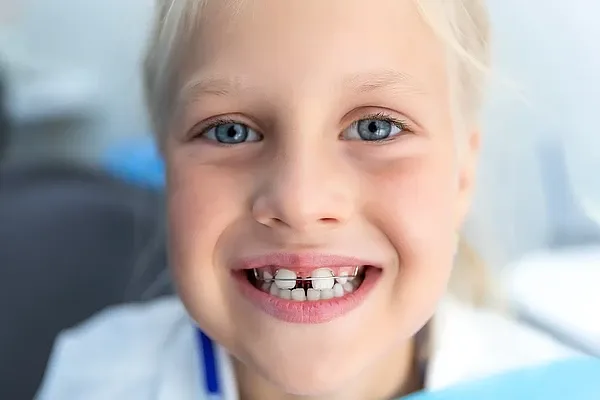 Kind mit herausnehmbarer Zahnspange während einer kieferorthopädischen Behandlung
