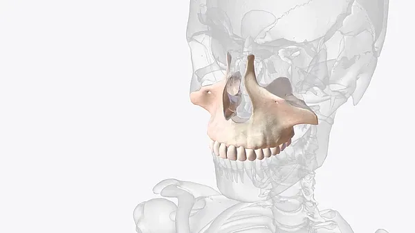 3D-Darstellung des Oberkiefers zur Veranschaulichung einer Oberkiefererweiterung und Gaumennahterweiterung bei Erwachsenen.